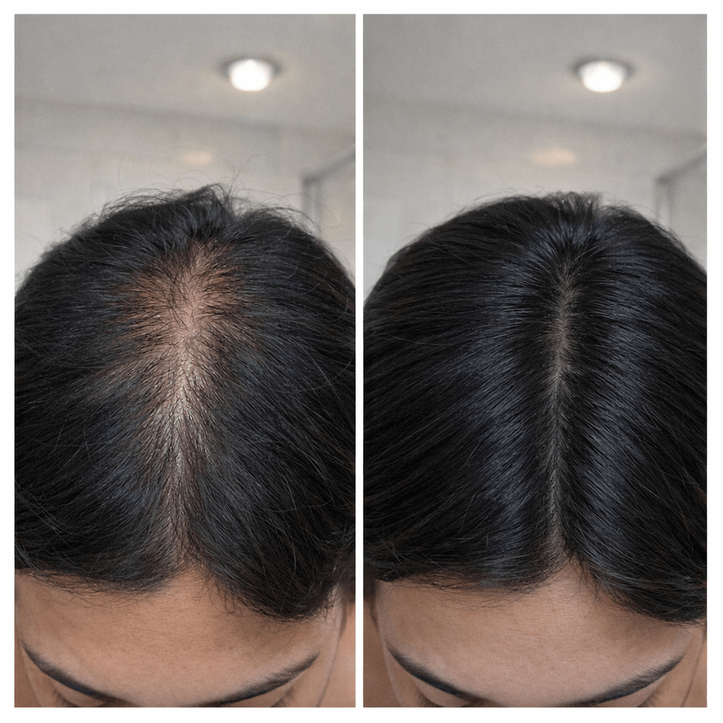 Antes e depois — resultado 4