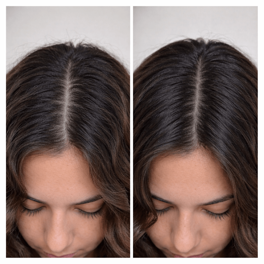 Antes e depois — resultado 5
